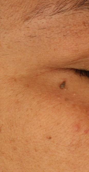Before image