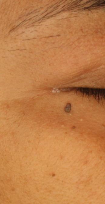 After image